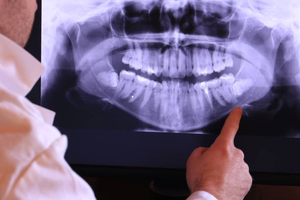Best Emergency Denture Repair in Wakeeney, KS
