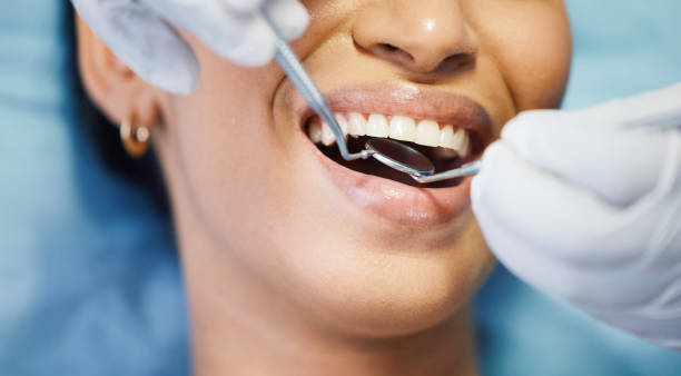Best Emergency Dental Care for Sports Injuries in Wakeeney, KS