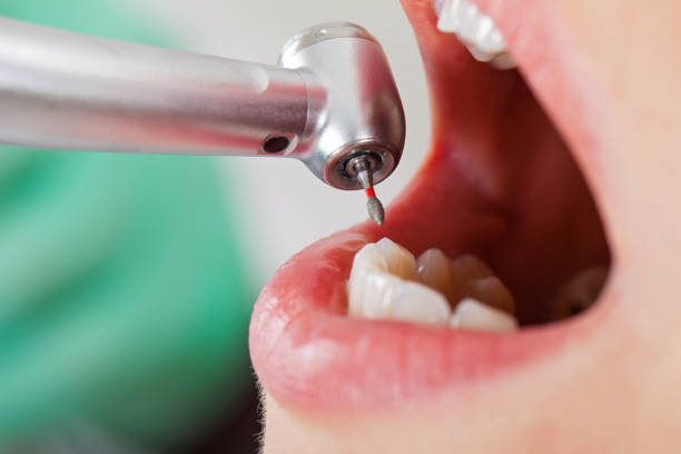Best Emergency Care for Gum Disease in Wakeeney, KS